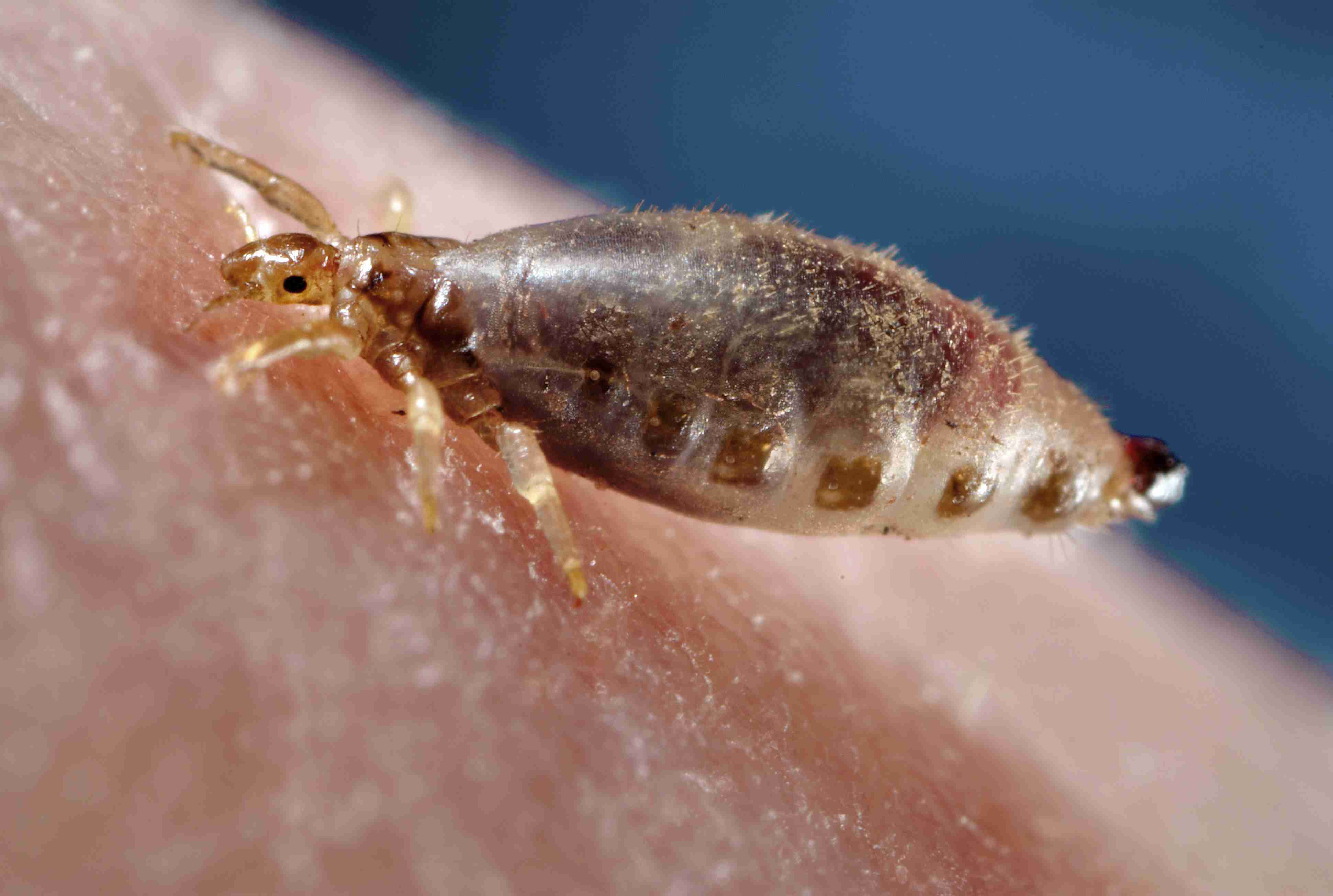 Human body louse, female, France