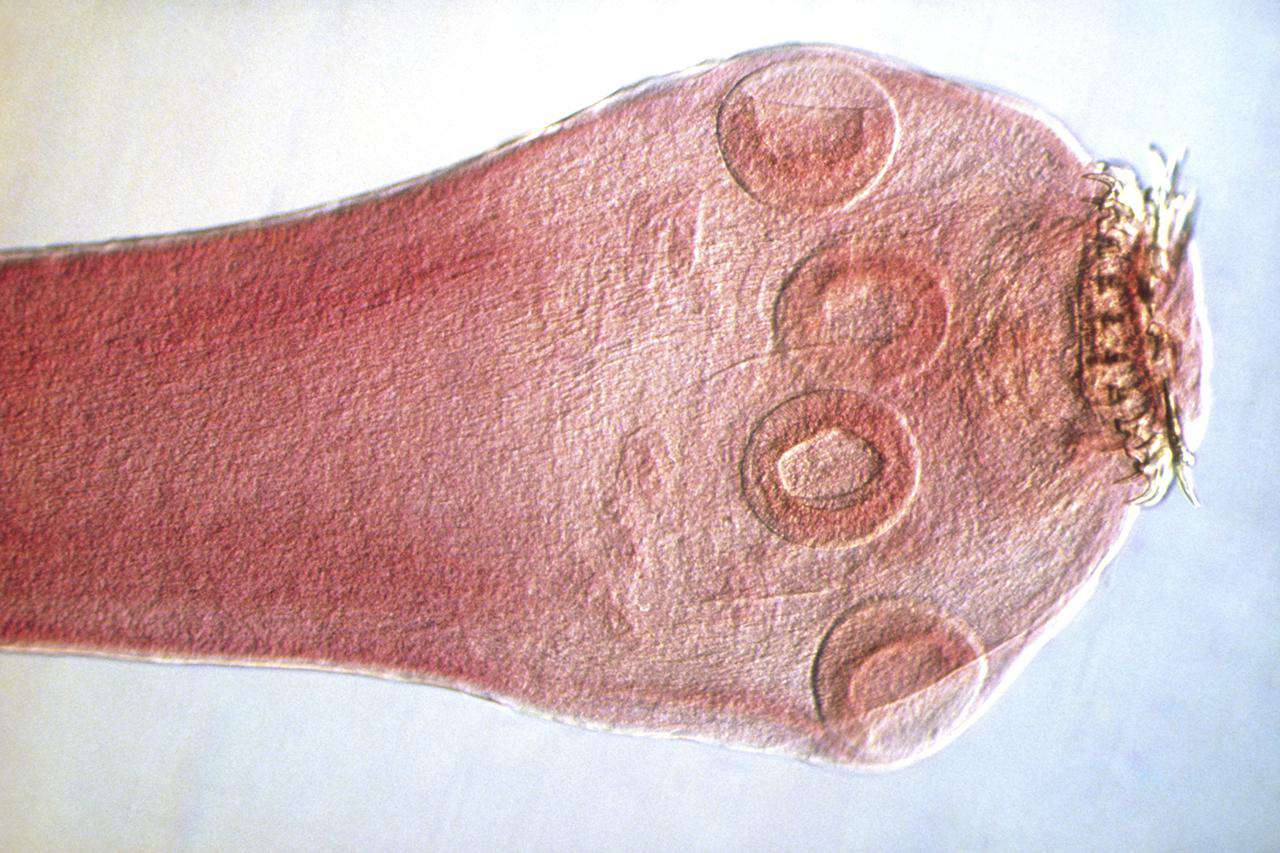 Light micrograph of parasitic tapeworm
