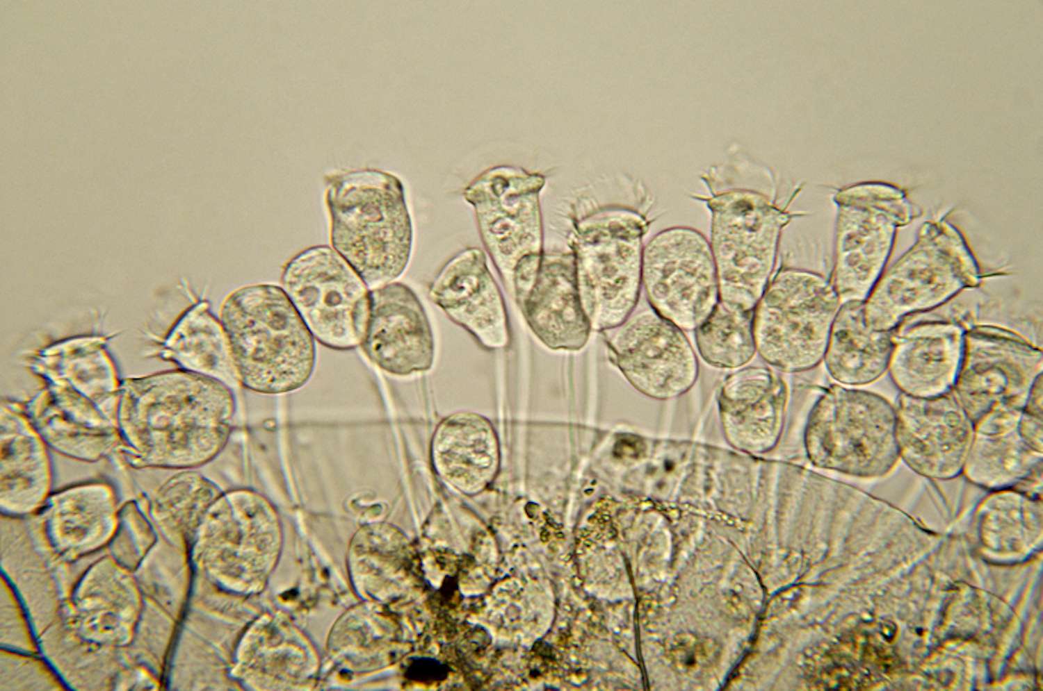 A micrograph of the vorticella species