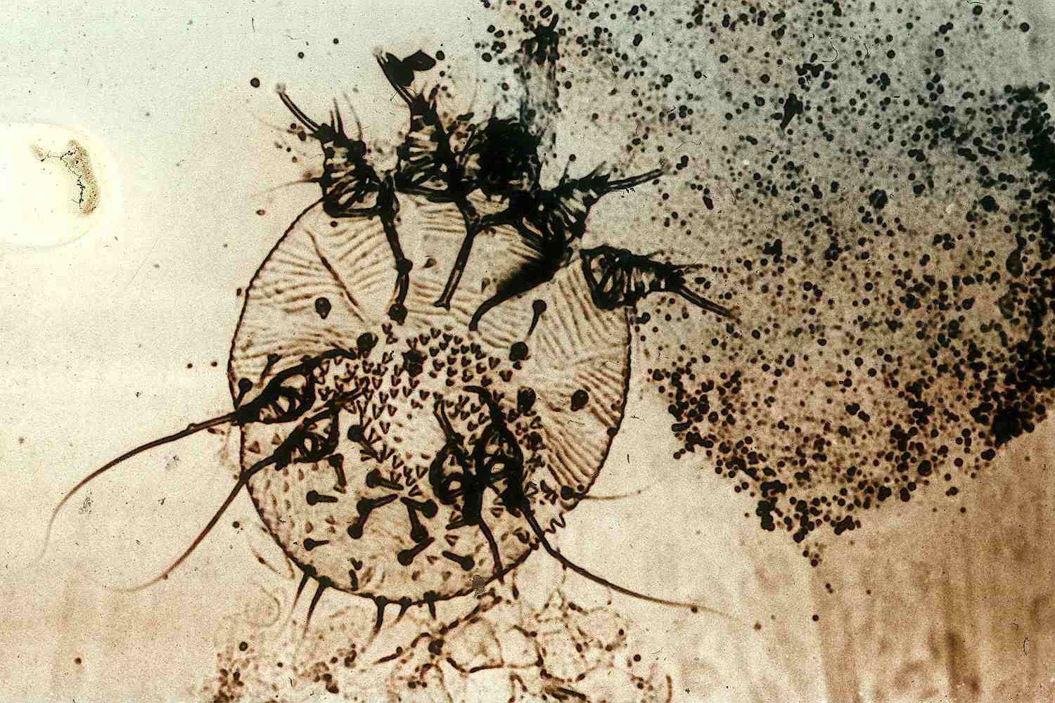 Microscopic view of a mange mite.