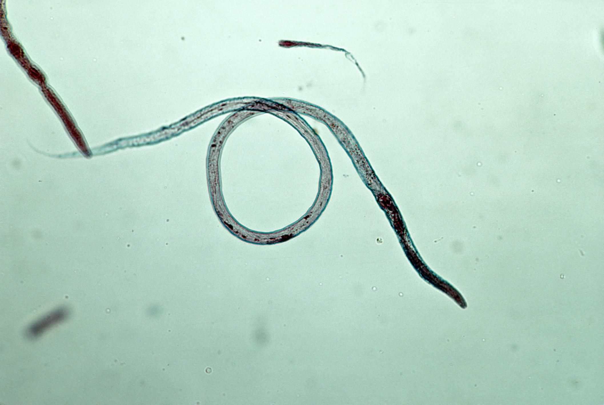 Roundworms (Toxocara canis) from a dog by Flukeman / Wikimedia Commons