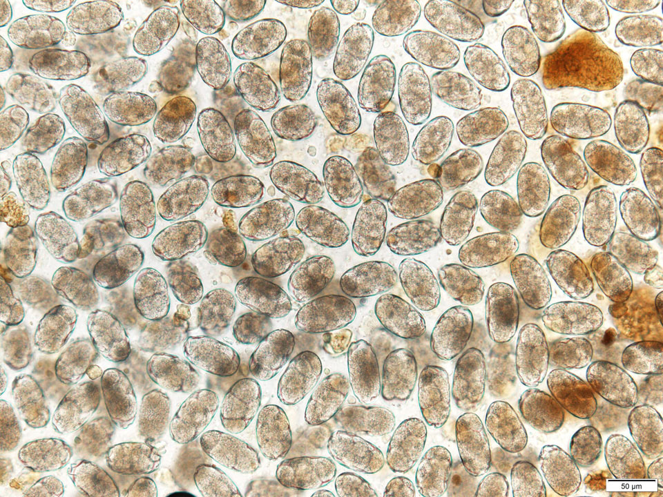Los huevos de anquilostomas se observan al microscopio.