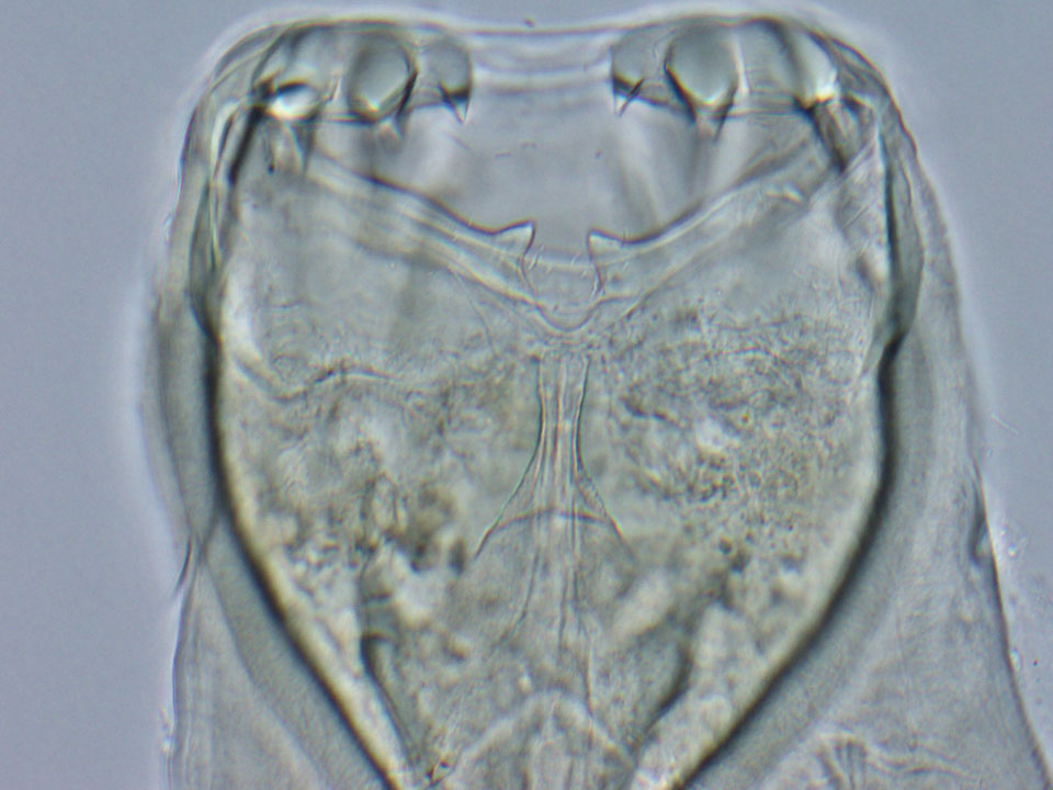 Los anquilostomas reciben su nombre de sus bocas en forma de gancho, vistas aquí bajo un microscopio.